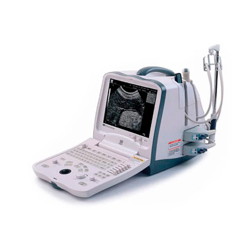 УЗИ аппарат Mindray DP-6600