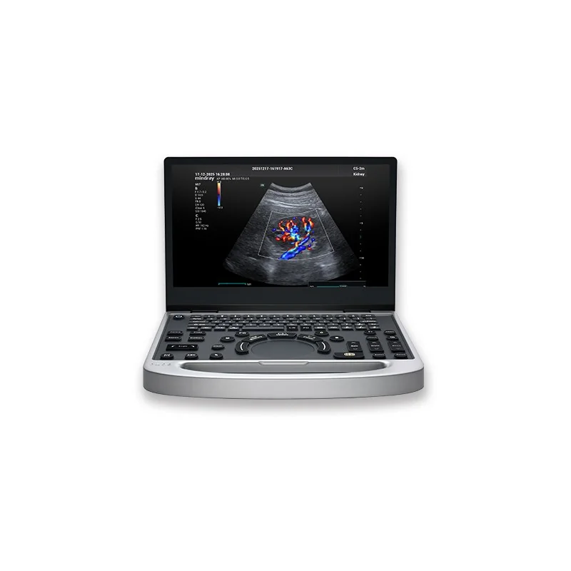 УЗИ аппарат Mindray MU7