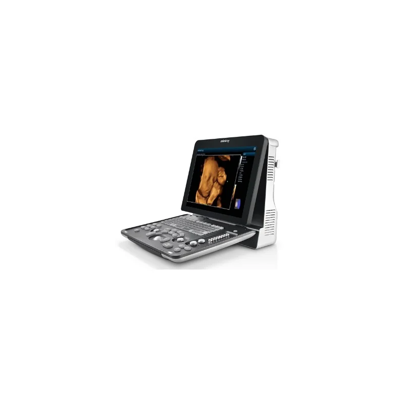 УЗИ аппарат Mindray Z60