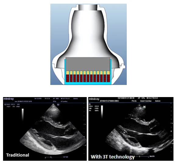3T Transducer Technology