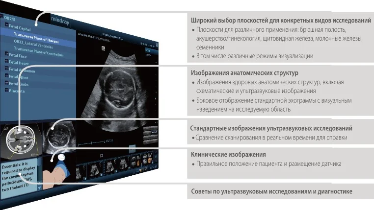 УЗИ аппарат Mindray DC-40 PRO — Гарантия безопасности и стабильности: