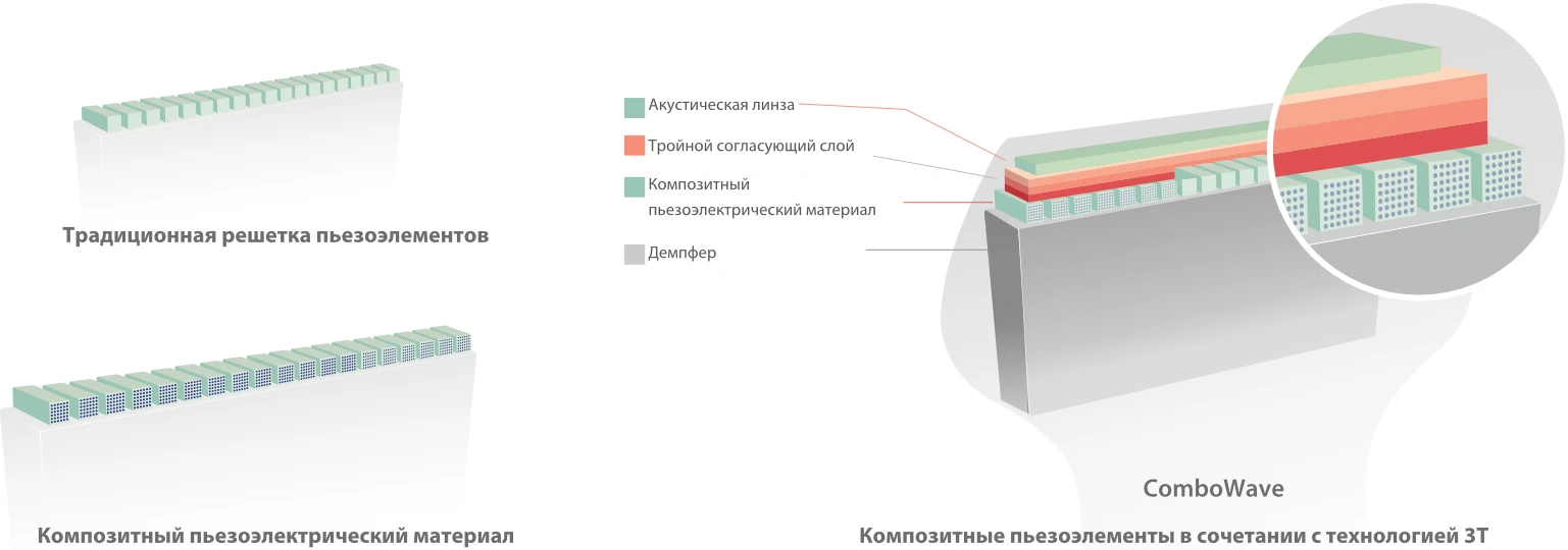 УЗИ аппарат Mindray DC-80 Exp — Датчики с технологией ComboWave