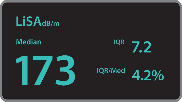 УЗИ аппарат Mindray Hepatus Series — Количественный анализ стеатоза печени
