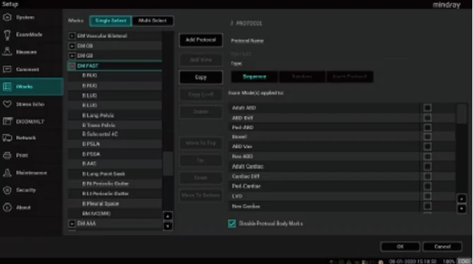 УЗИ аппарат Mindray ME-7 — Эффективный рабочий процесс