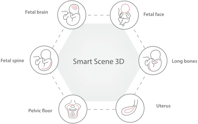 УЗИ аппарат Mindray Imagyn I9 — Imagyn I9
