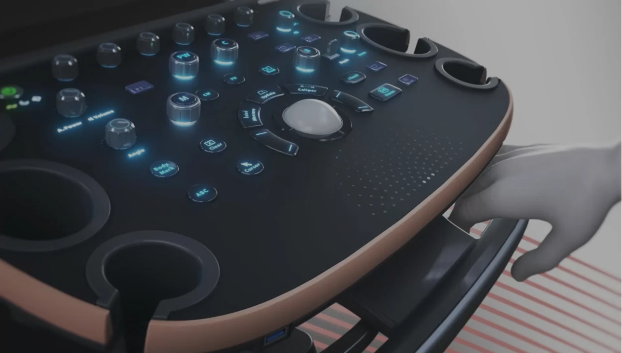 УЗИ аппарат Mindray Nuewa I9 Elite Edition — Возможность проведения исследования у постели пациента без необходимости подключения кабеля питания