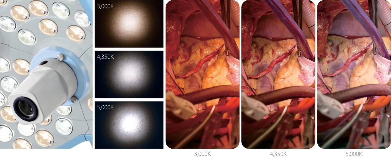 Хирургический светильник Mindray Серия HyLED 8