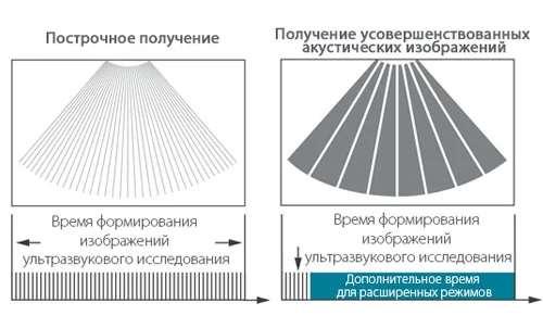 Получение усовершенствованных акустических изображений - Mindray Resona 6
