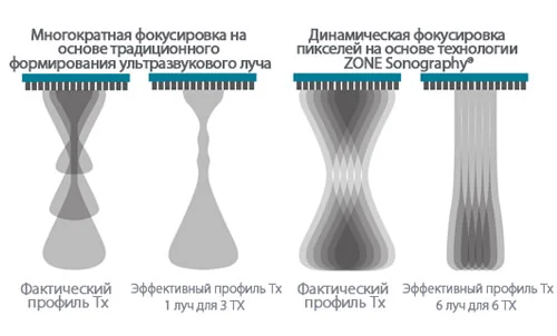 Динамическая фокусировка пикселей - Mindray Resona 6