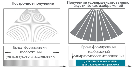 УЗИ аппарат Mindray Resona 7 — Получение усовершенствованных акустических изображений