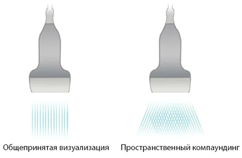 Mindray Z5 iBeam