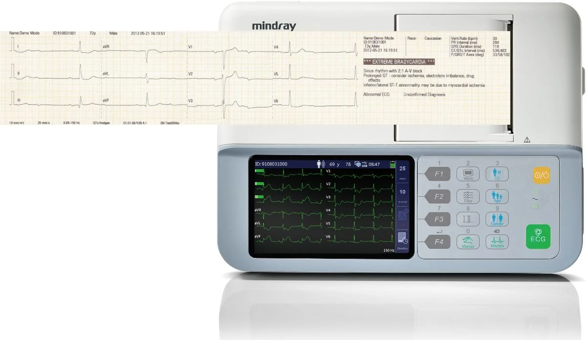 Электрокардиограф Mindray BeneHeart R3 — анализ записи