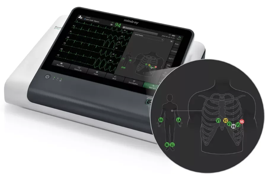 Электрокардиограф Mindray BeneHeart R700/R900 — индикация состояния электродов