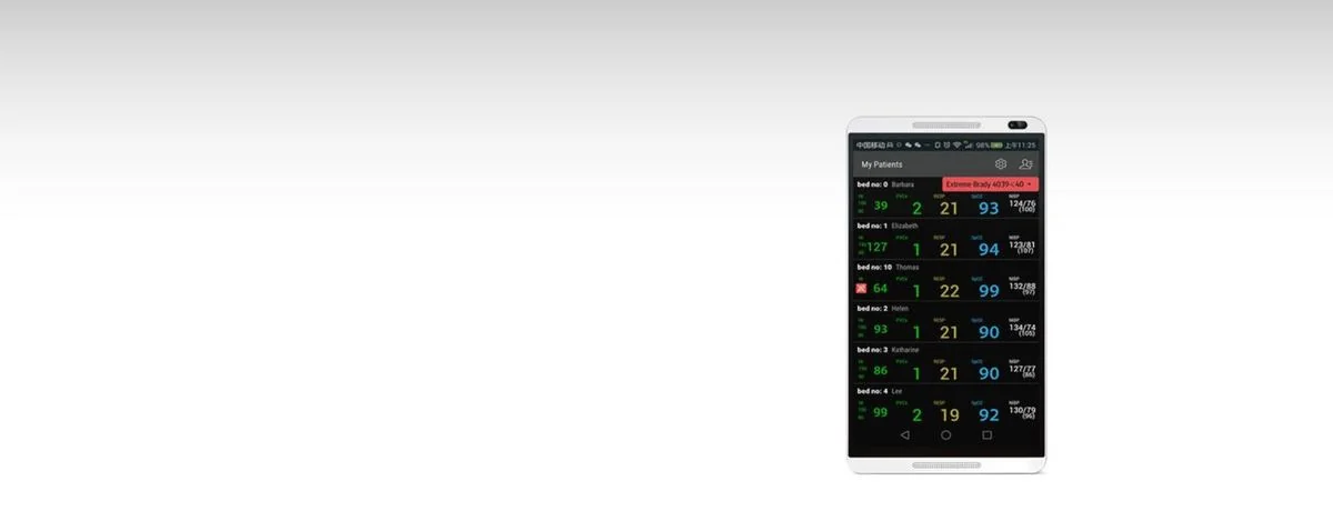 Монитор пациента Mindray BeneVision CMS Mobile Viewer