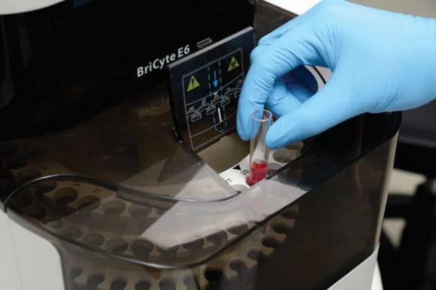 Проточный цитометр Mindray BriCyte E6 — позиция срочной пробы