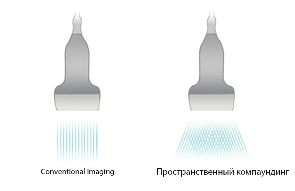 УЗИ аппарат Mindray DP-50 — IBeam TM