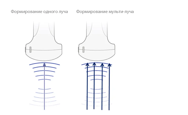 УЗИ аппарат Mindray DP-50 — формирование мульти-луча