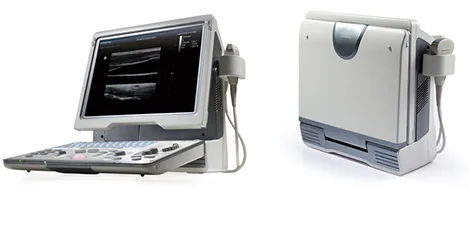 УЗИ аппарат Mindray DP-50 — эргономика