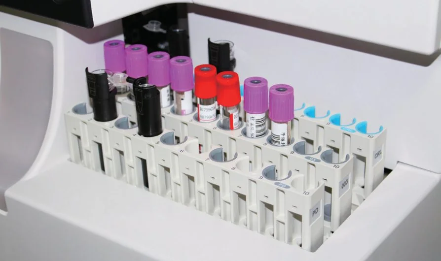 Анализатор гликированного гемоглобина Mindray H50 — * NGSP — National Glycohemoglobin Standardization Program