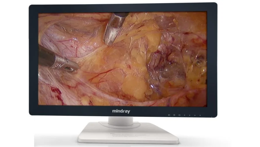 Mindray HD3: блок управления камерой и головка видеокамеры — монитор PV27 FHD