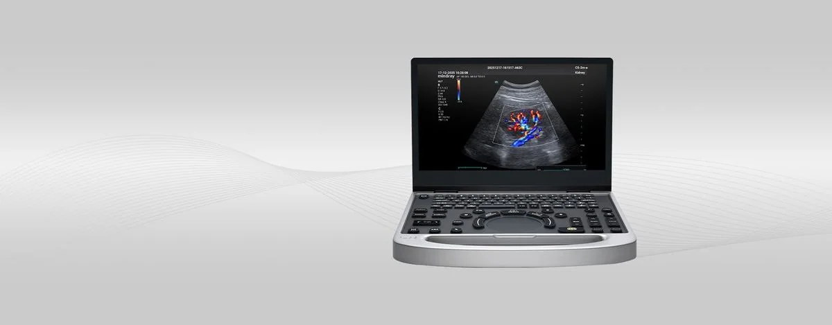 УЗИ аппарат Mindray MU7