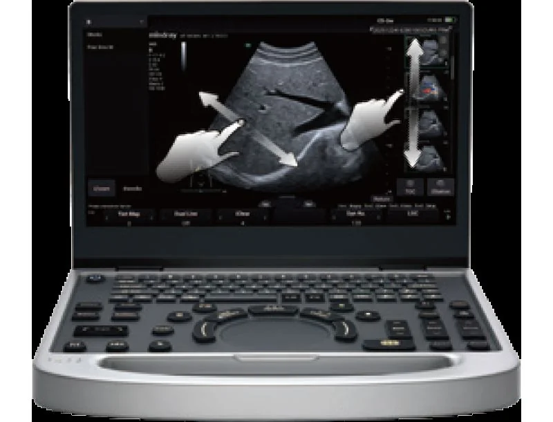 УЗИ аппарат Mindray MU7