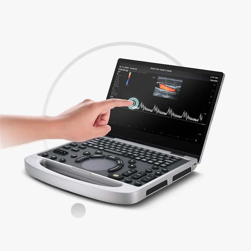 УЗИ аппарат Mindray MU9