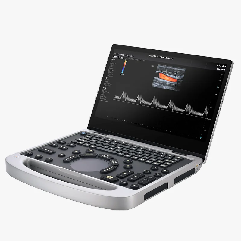 УЗИ аппарат Mindray MU9