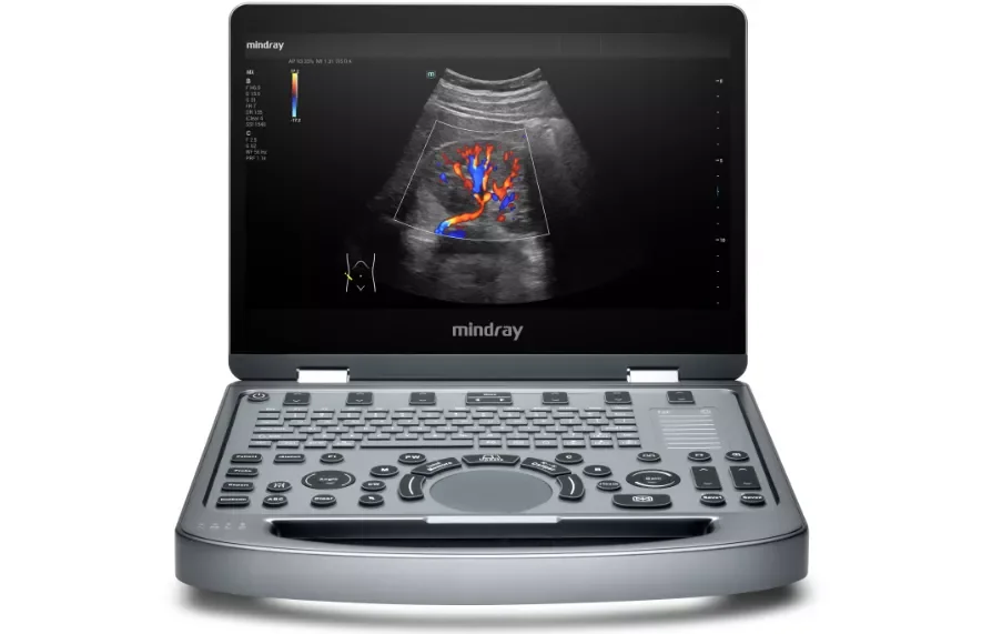 УЗИ аппарат Mindray MX6