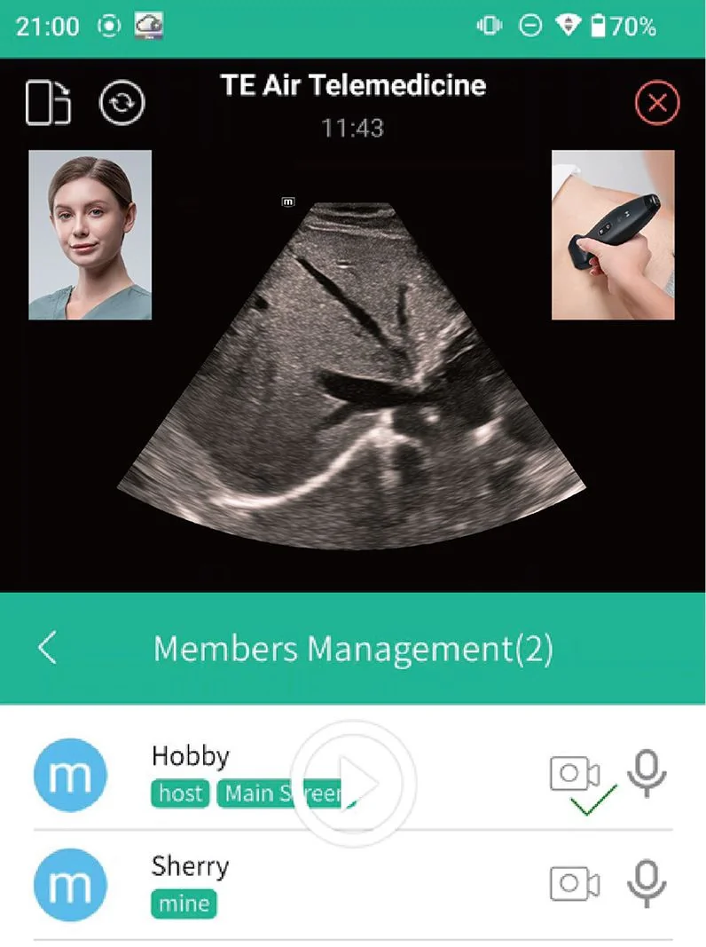 УЗИ аппарат Mindray TE Air e5M