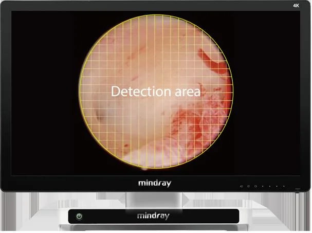 Эндоскопическая видеосистема Mindray UX3 Series 4K